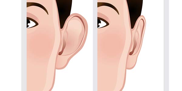 عوارض جراحی گوش چیست